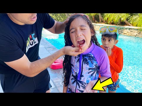 Can&#039;t BELIEVE George BROKE Suri&#039;s TOOTH!! *Extremely Painful* | Jancy Family